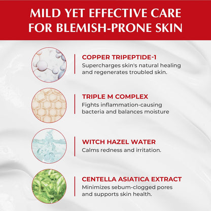 Effective Peptide Acne Control Lotion