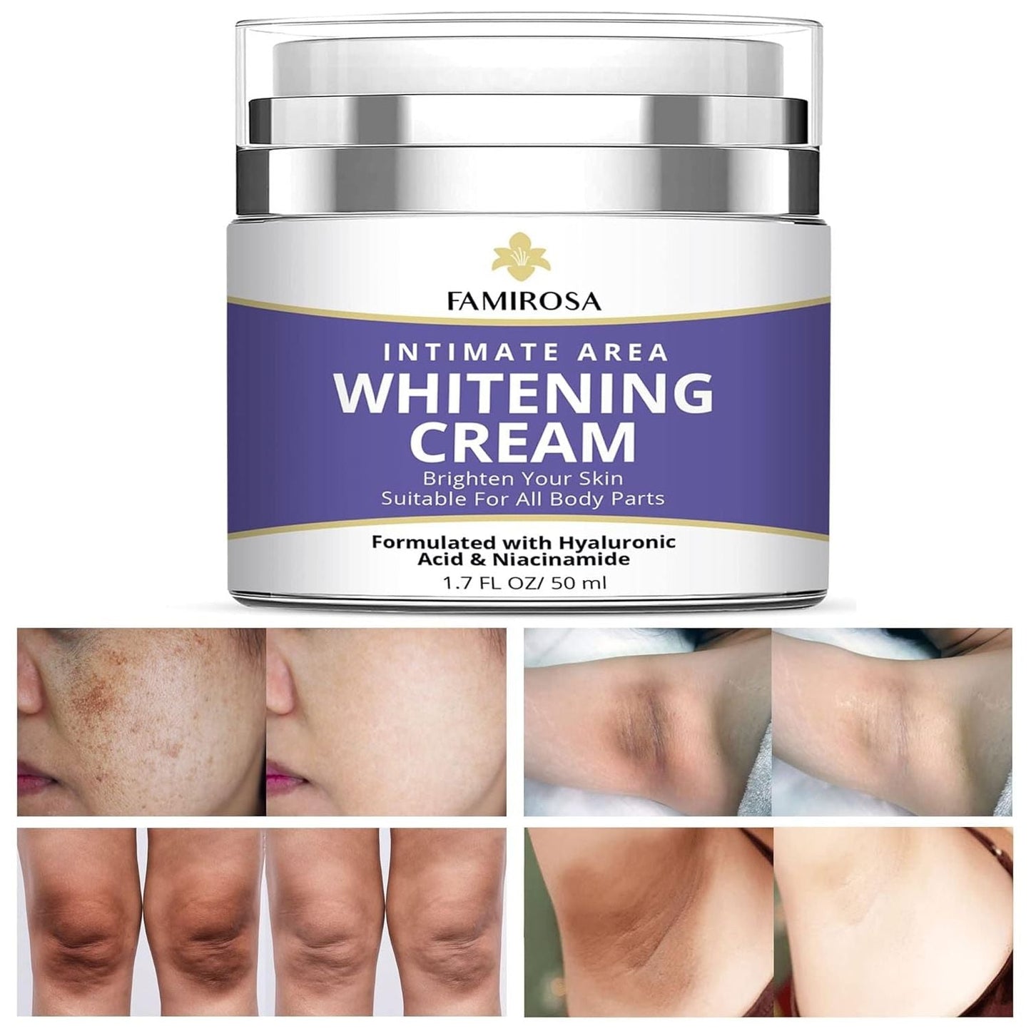 Gentle Skin Brightening Cream for Sensitive Areas - Mycosmeticslondon