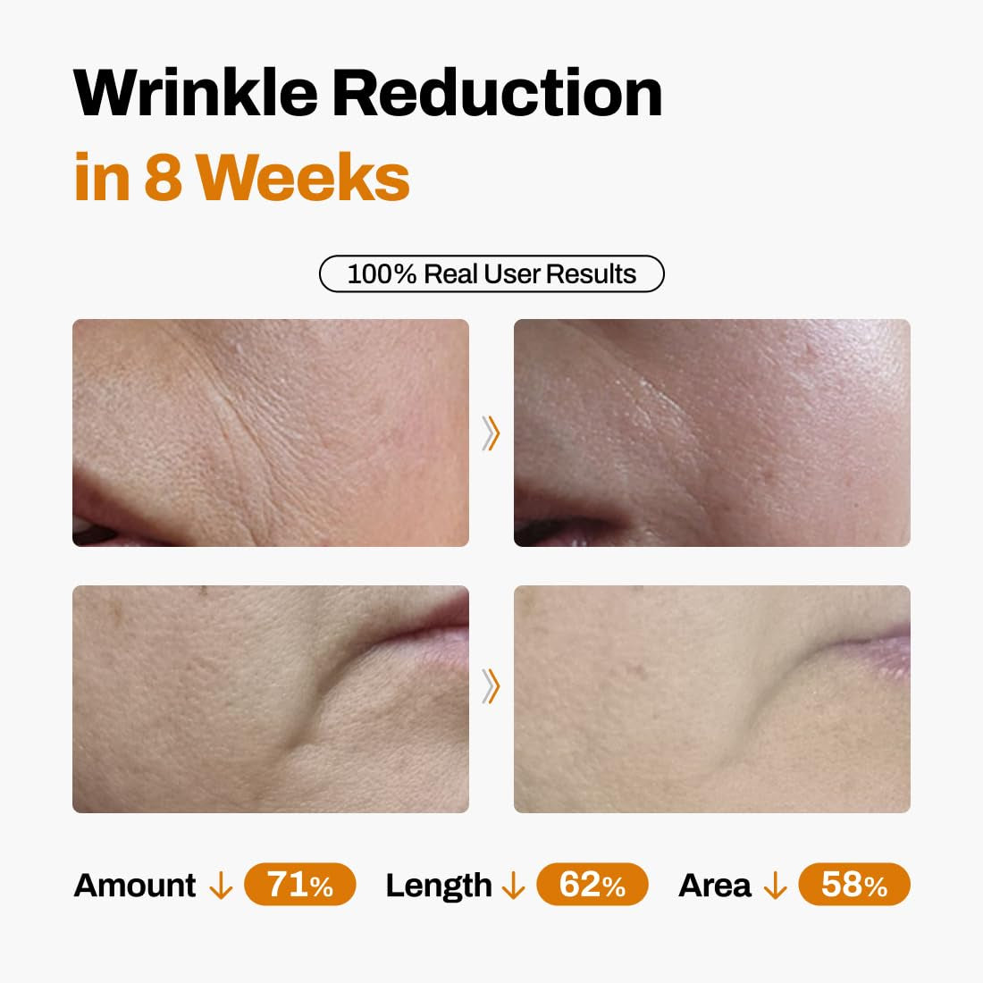 Advanced Anti Aging Skin Lift Kit