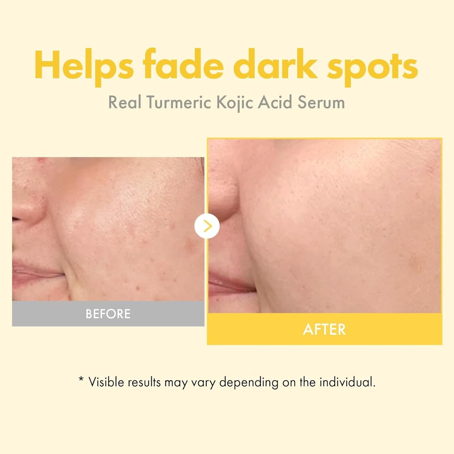 Natural Turmeric Brightening Face Serum 33ml
