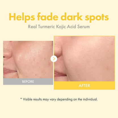 Natural Turmeric Brightening Face Serum 33ml