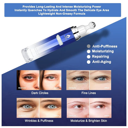 Anti Aging Eye Serum - 15ml Dark Circle Remover