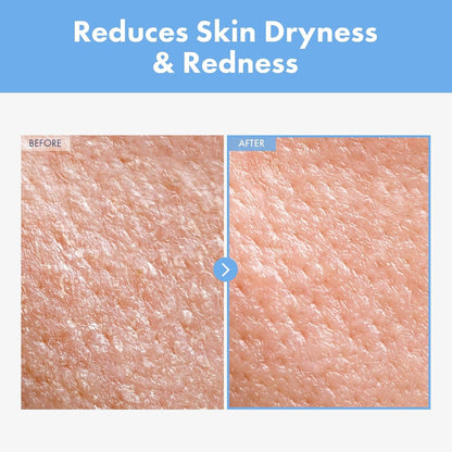 Gentle Moisturizing Cream for Dry Sensitive Skin