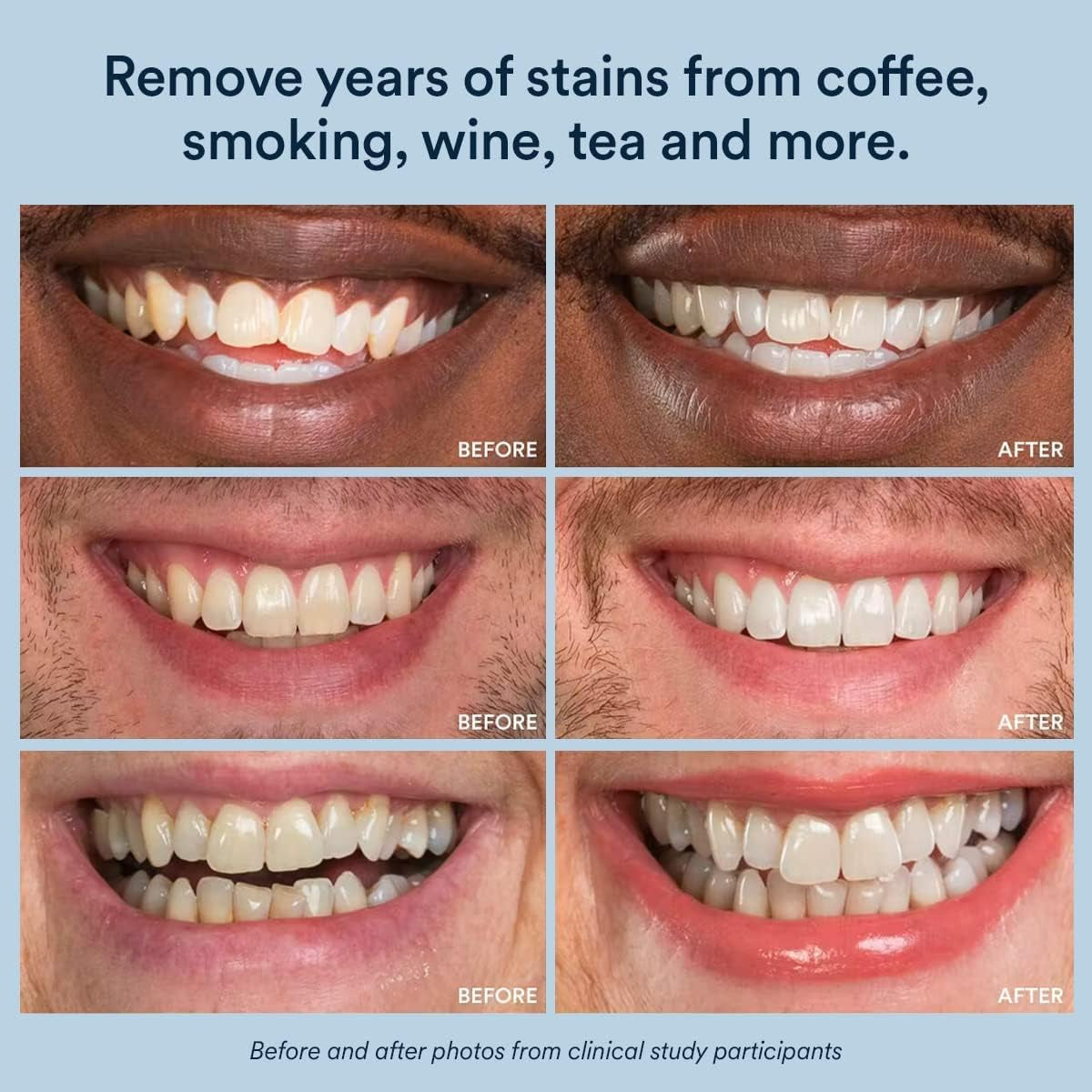 Bright Smile Whitening Gel Booster 73g