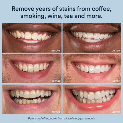 Bright Smile Whitening Gel Booster 73g