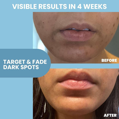 Glowing Skin Serum 12% Niacinamide + 2% Zinc
