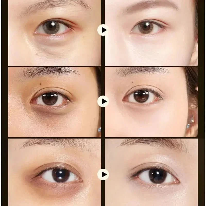 Moisturizing Collagen Eye Masks - Refresh and Rejuvenate Eyes