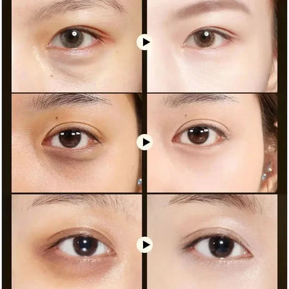 Moisturizing Collagen Eye Masks - Refresh and Rejuvenate Eyes