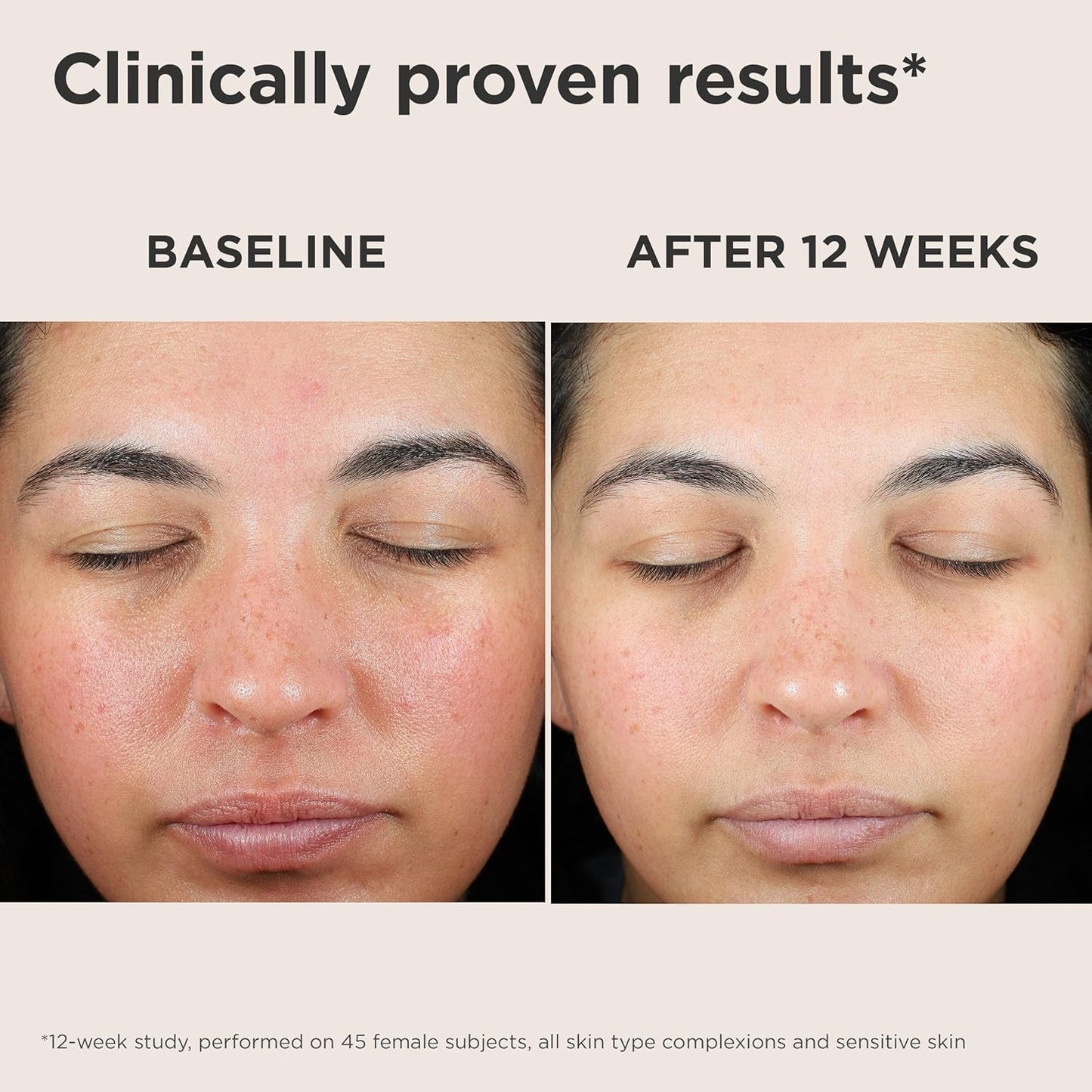 Gentle Daily Face Sunscreen SPF 50 for Sensitive Skin