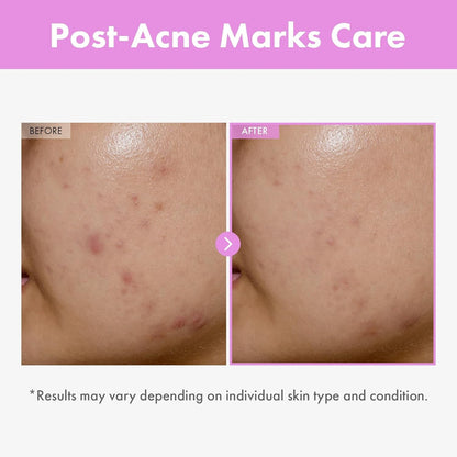 Anti Aging Face Serum 150ml - Plumping Hydrating Toner