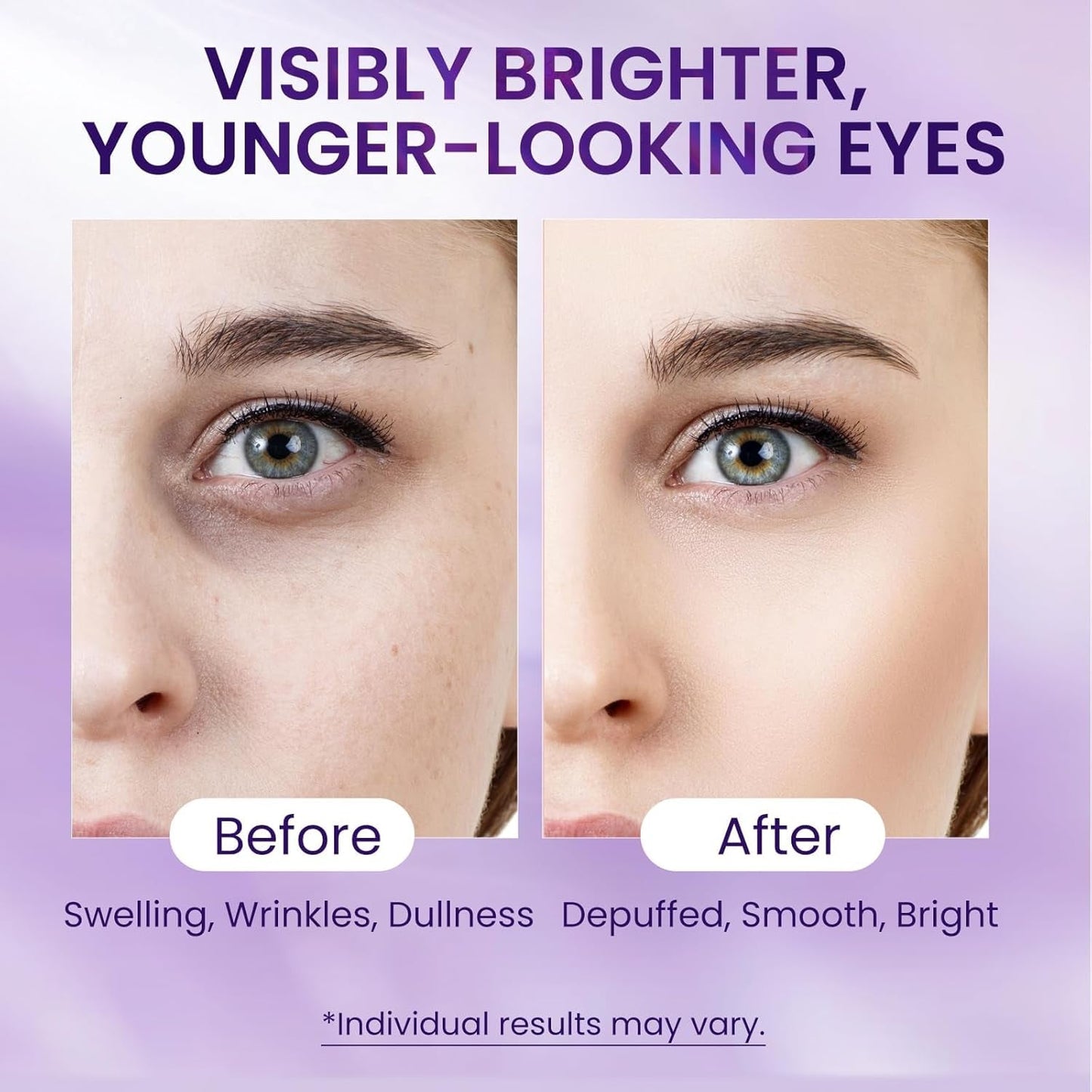 Anti Aging Eye Serum 20ml - Moisturizing Dark Circle Remover