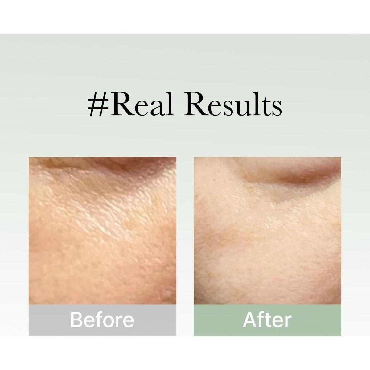 Nourishing Hyssop Face Serum 50ml - Moisturizing Glow