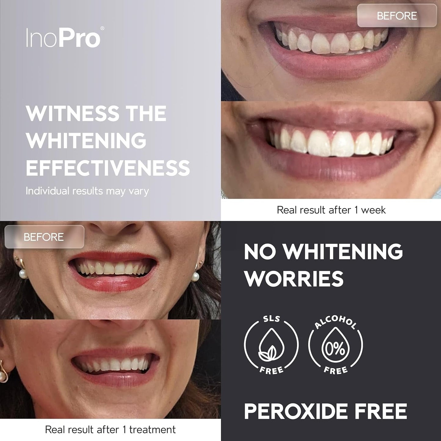 Effective At Home Teeth Whitening Strips 21 Count