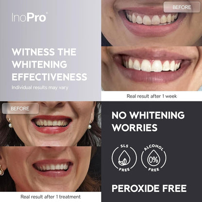 Effective At Home Teeth Whitening Strips 21 Count