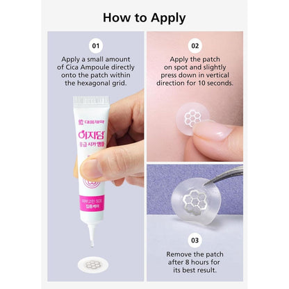 Soothing Magnesium Acne Patches - 30 Count Korean Spot Treatment
