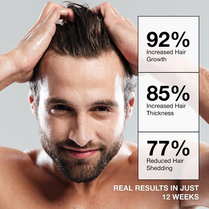 Natural Hair Growth Shampoo for Men 300ml