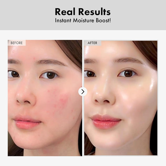 TOSOWOONG Intensive Hydrating Serum 100ml Moisture & Skin Repair