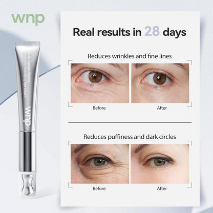 Anti Aging Eye Cream with Massager & Peptides 15g