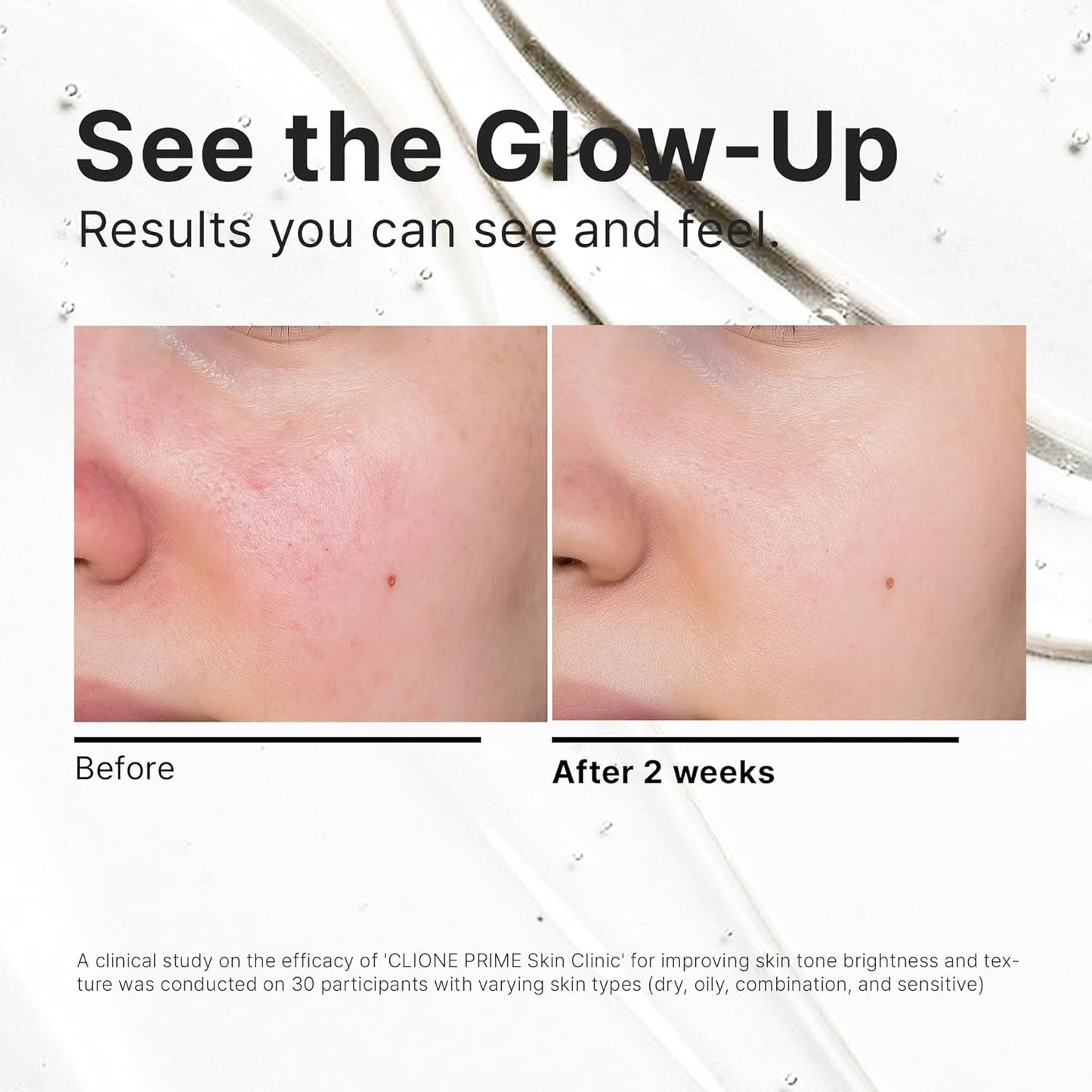 Anti Aging Korean Skin Care Kit for Women