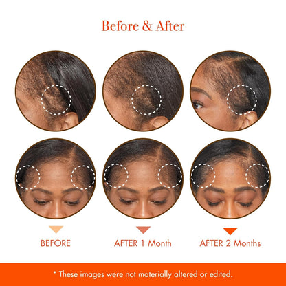 Nourishing Hair Growth Serum for Dry Scalp Treatment