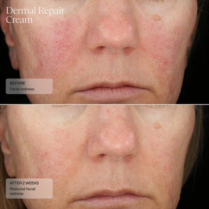 Soften & Hydrate Facial Moisturizer Cream