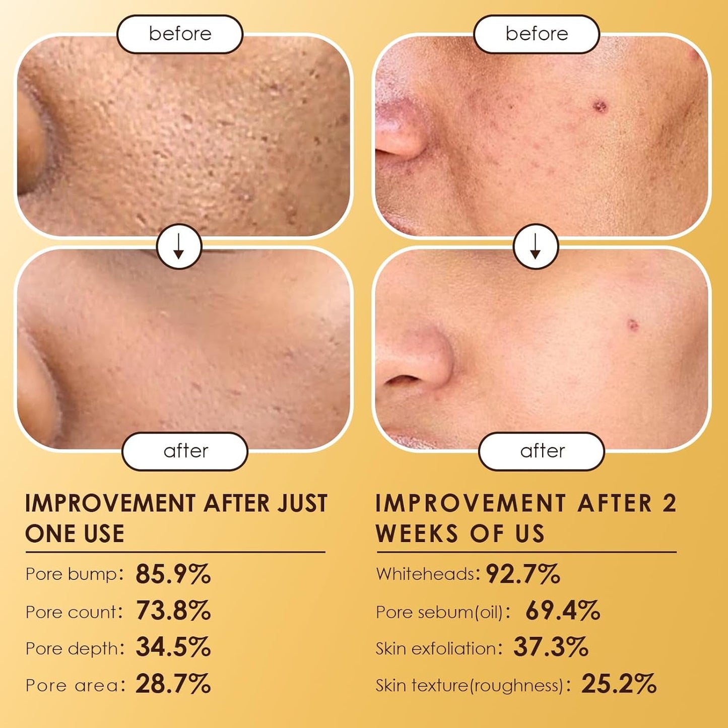 Gentle Exfoliating Face Serum Duo 80ml
