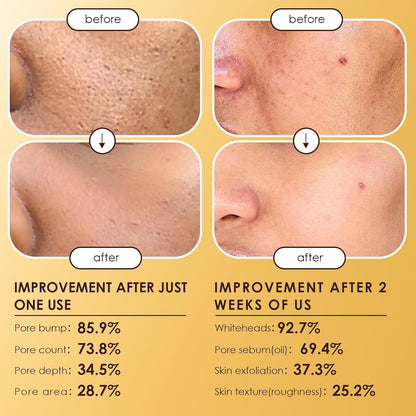 Gentle Exfoliating Face Serum Duo 80ml
