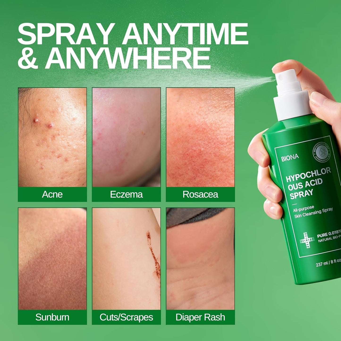 Gentle Skin Soothing Spray 237ml