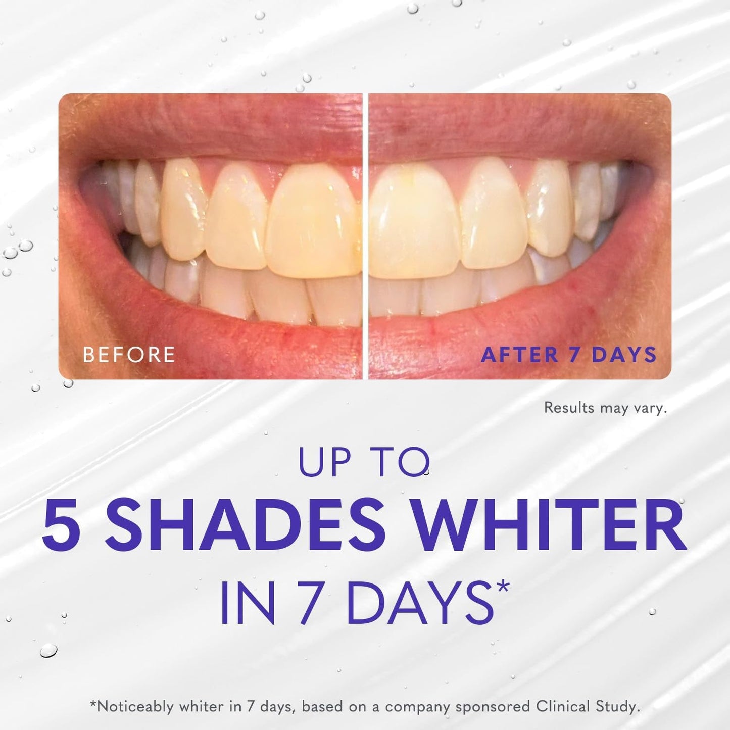 Effective At-Home Teeth Whitening Gel 60ml