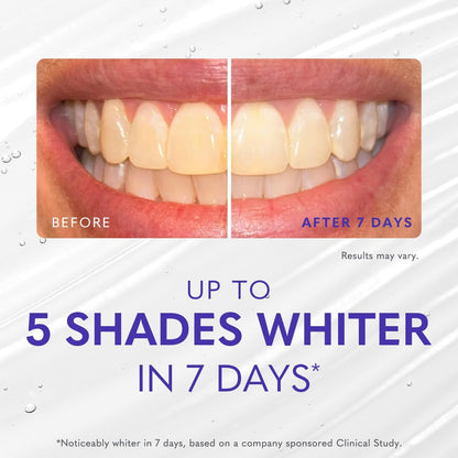 Effective At-Home Teeth Whitening Gel 60ml