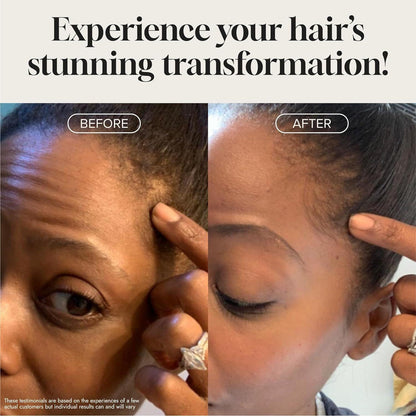 Nourishing Biotin Hair Regrowth Serum 60ml