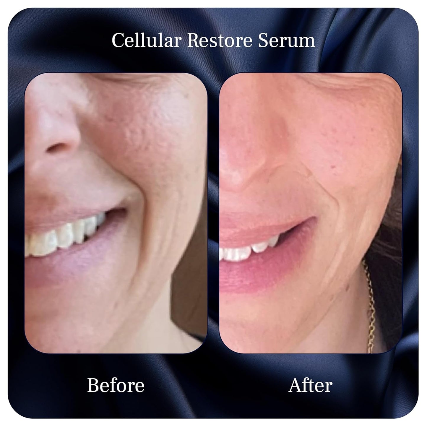 Natural Anti Aging Face Serum - Reduces Wrinkles