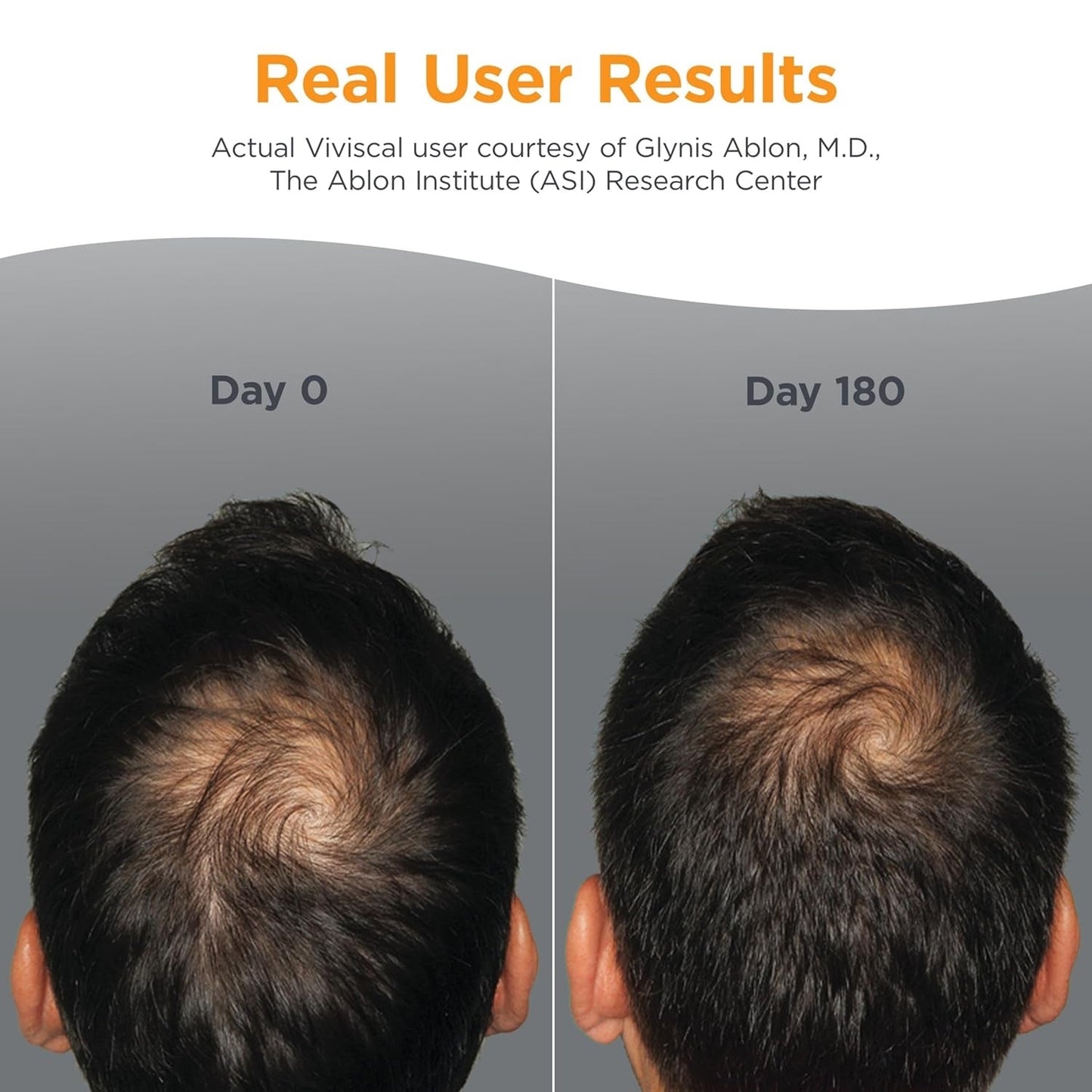 Natural Hair Growth Supplements for Men - 60 Tablets
