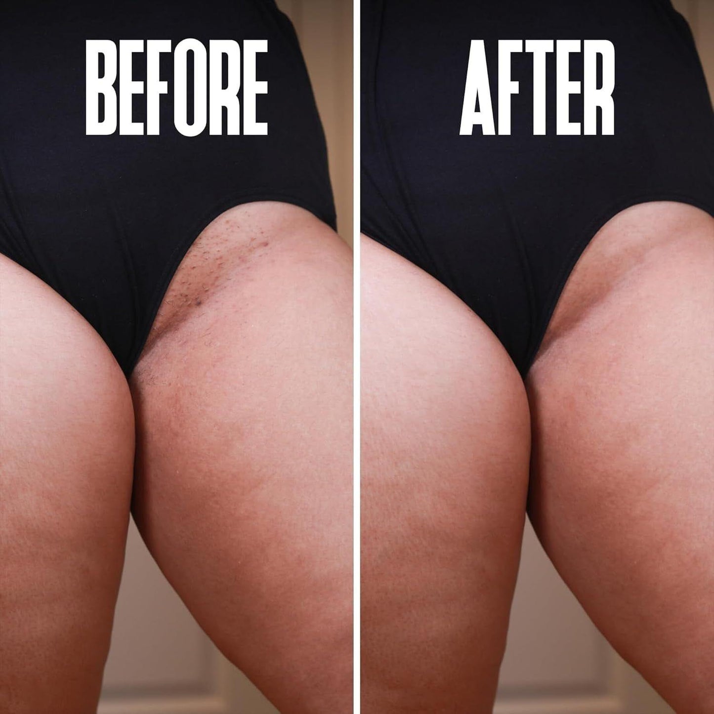 Soothing Ingrown Hair Removal Pads