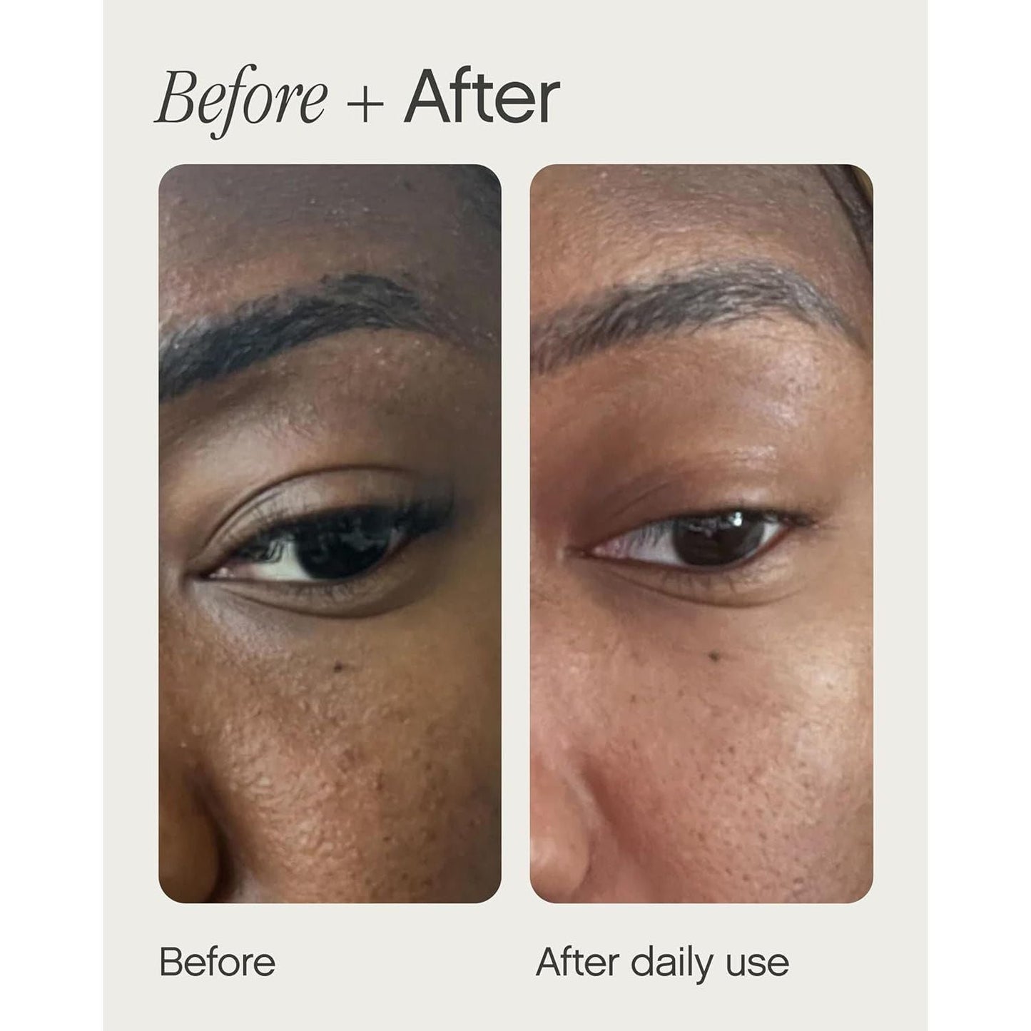 Effective Scar Reduction Cream 28ml