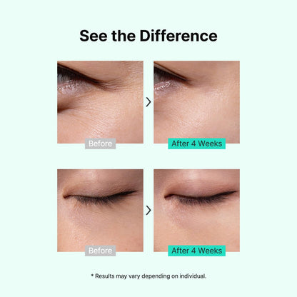 Anti Aging Eye Cream with Bakuchiol - Reduces Puffiness