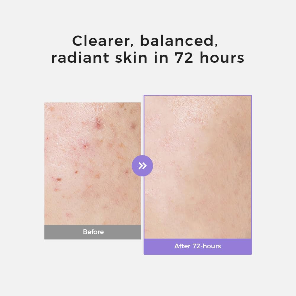 Natural Brightening Face Serum for Even Skin Tone