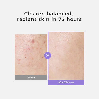 Natural Brightening Face Serum for Even Skin Tone