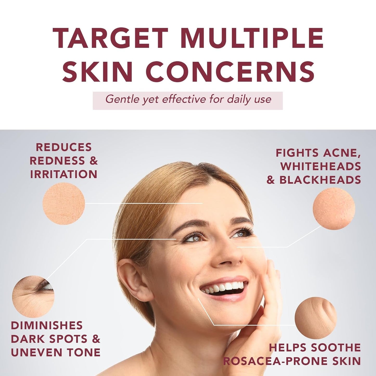 Gentle Azelaic Acid Face Serum for Soothing Red Skin