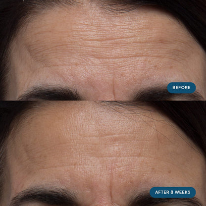 Natural Anti Aging Skin Vitamin Capsules