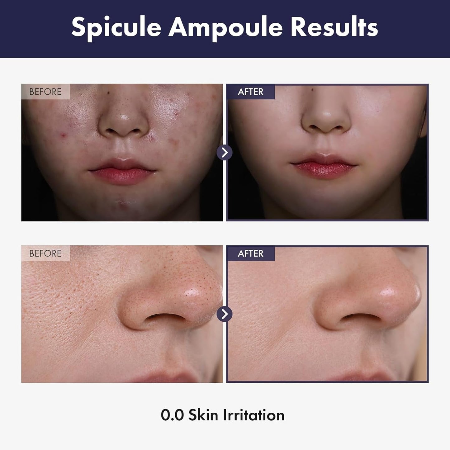 Natural Brightening Face Serum 30ml Minimizing Pores