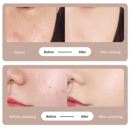 Professional Skin Tag Removal Laser Pen