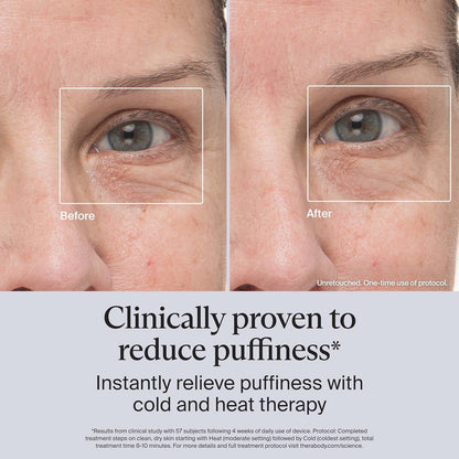 Compact Facial Massager for Puffy Skin Relief