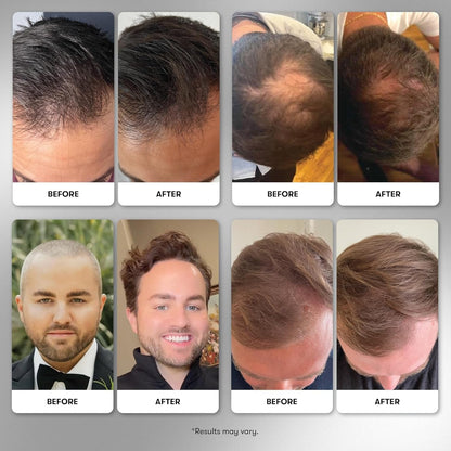 Natural Hair Growth Vitamins for Men - 90 Capsules
