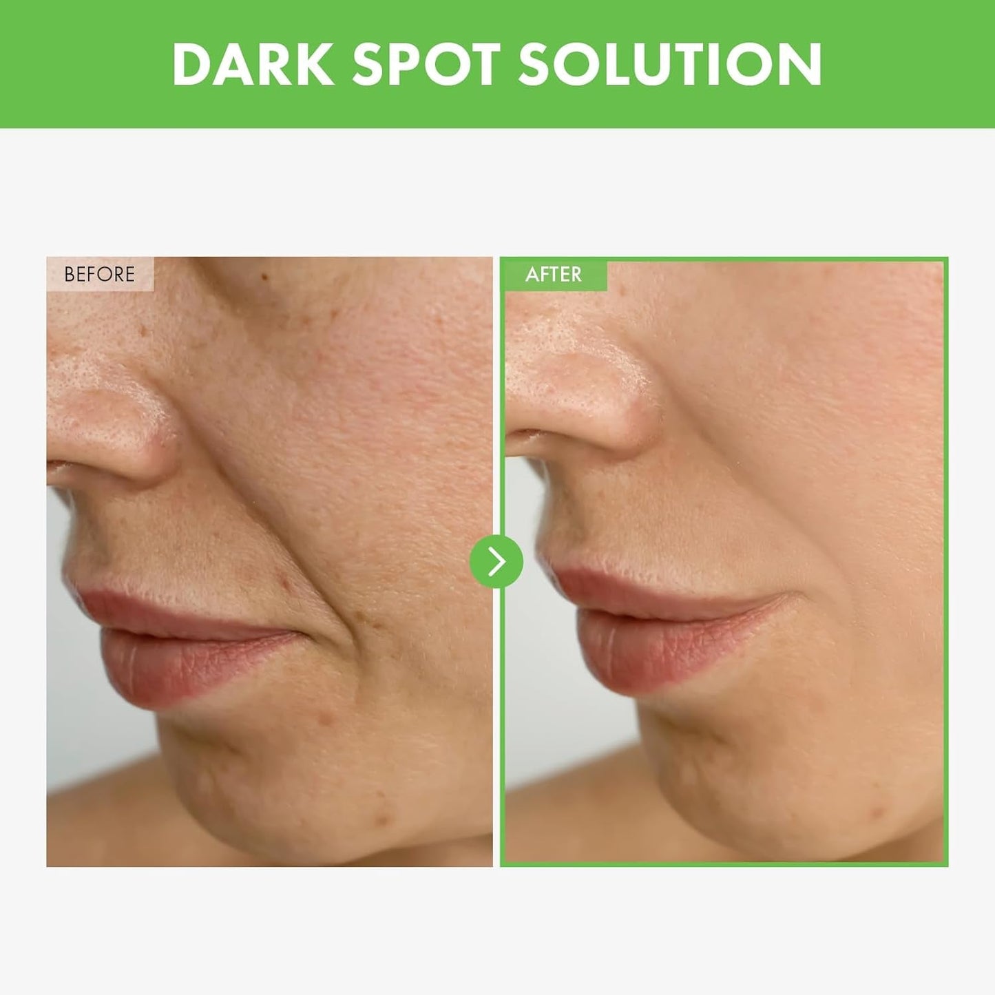Natural Kakadu Plum Spot Corrector Cream 50g