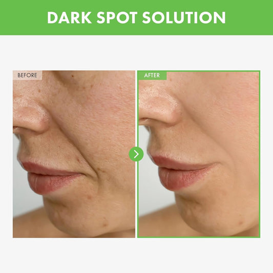 Natural Kakadu Plum Spot Corrector Cream 50g