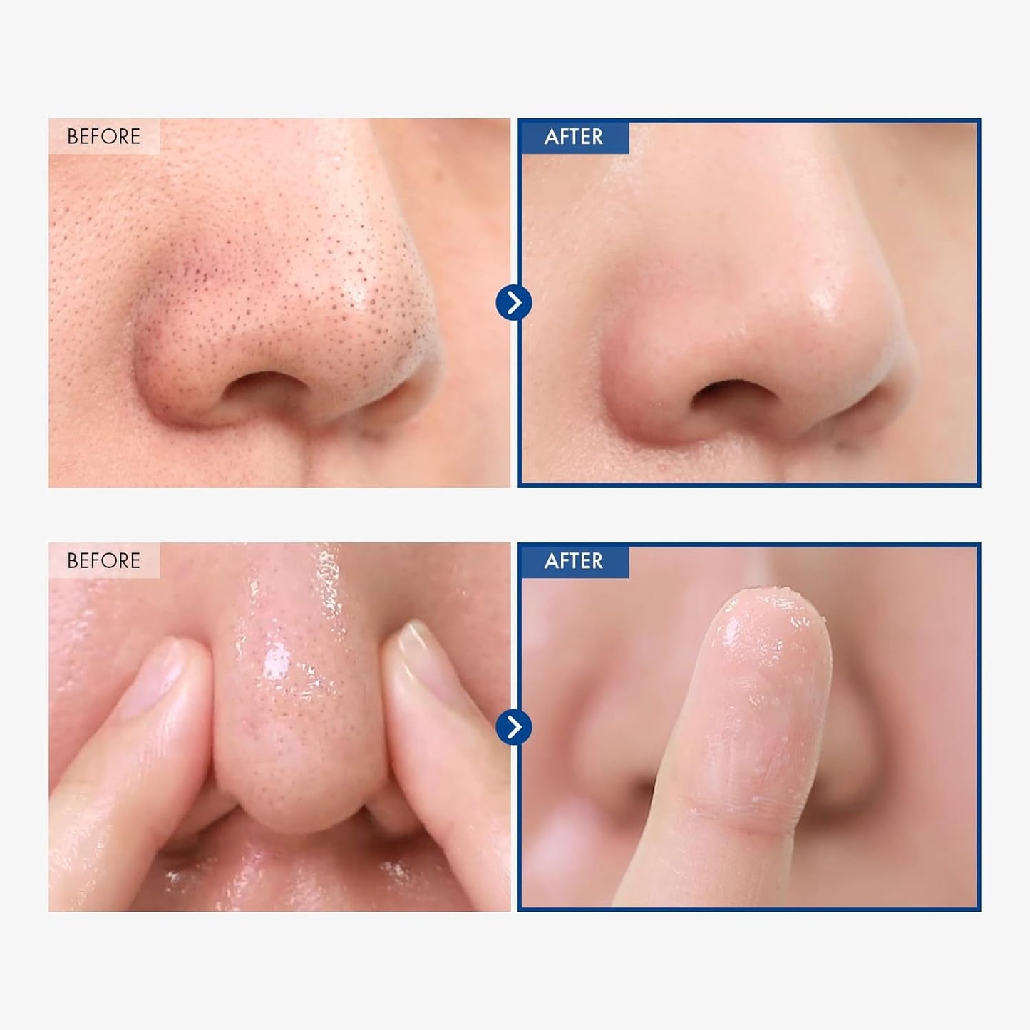 Gentle Blackhead Removal Facial Cleansing Oil