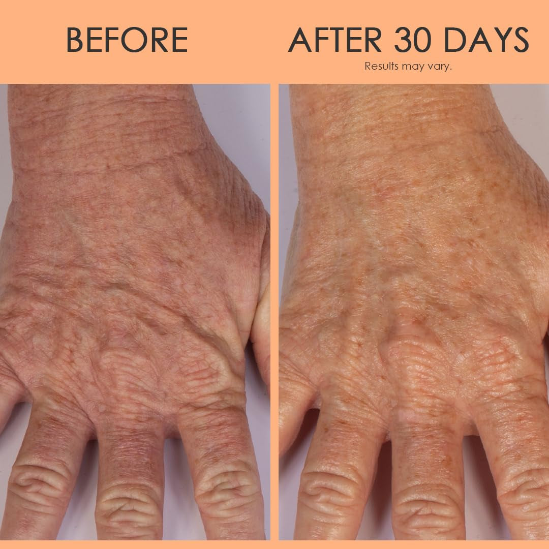 Rich Nourishing Hand Cream for Dry Aging Skin