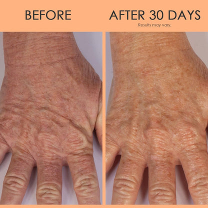 Rich Nourishing Hand Cream for Dry Aging Skin