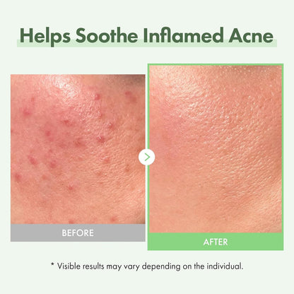 Natural Anti Redness Face Serum 33ml